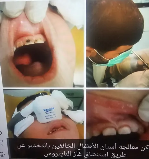 توثيق مصور للعناية بأسنان طفل، ويتضمن المنشور إشارة إلى استنشاق غاز النيتروس.
