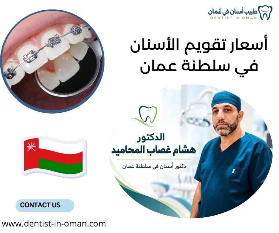 أسعار تقويم الأسنان في سلطنة عمان
