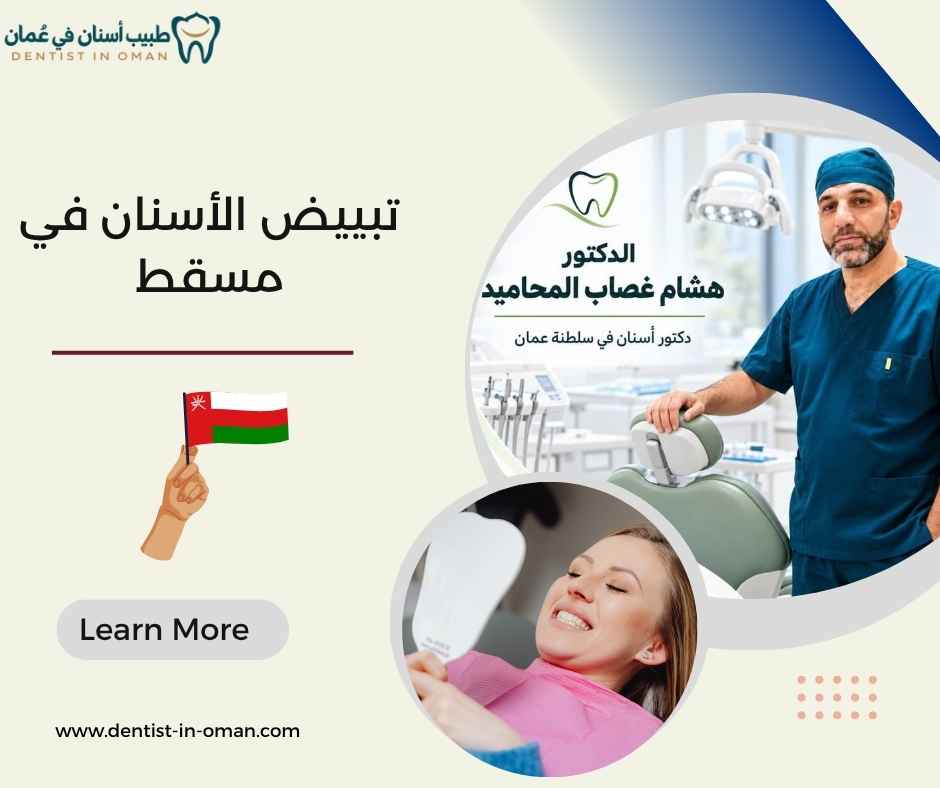 تبييض الأسنان في مسقط تبييض الأسنان في مسقط