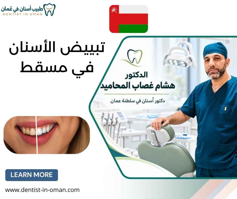 تبييض الأسنان في مسقط تبييض الأسنان في مسقط