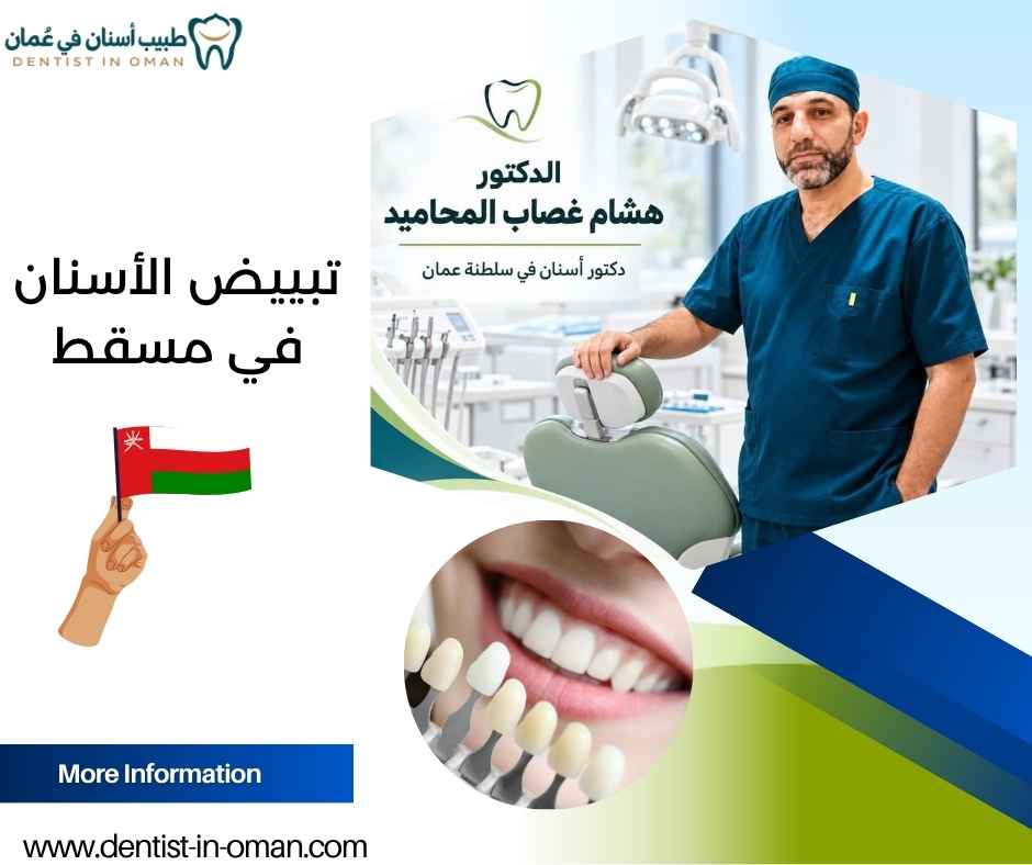 تبييض الأسنان في مسقط تبييض الأسنان في مسقط
