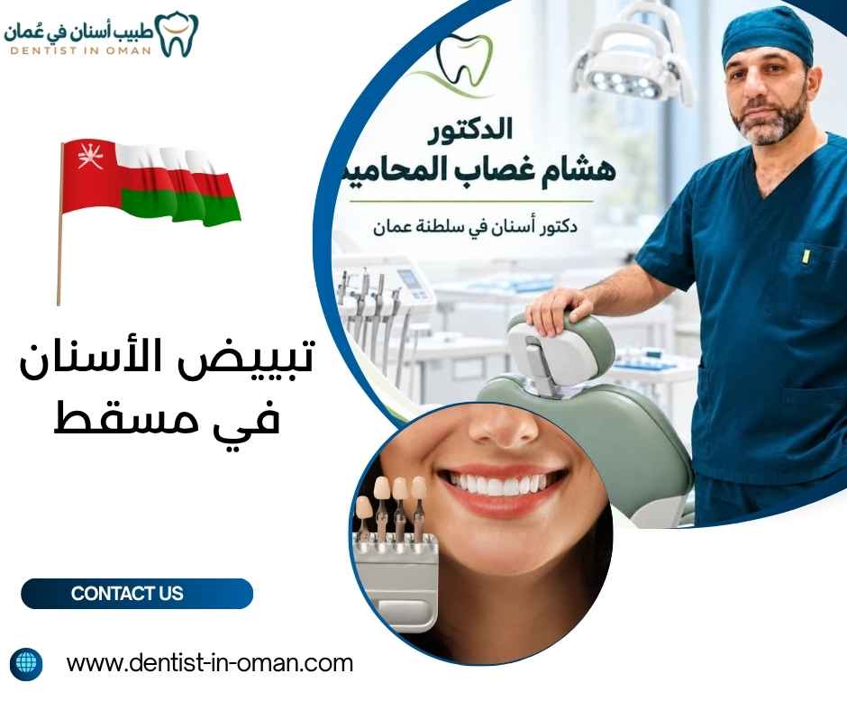تبييض الأسنان في مسقط تبييض الأسنان في مسقط