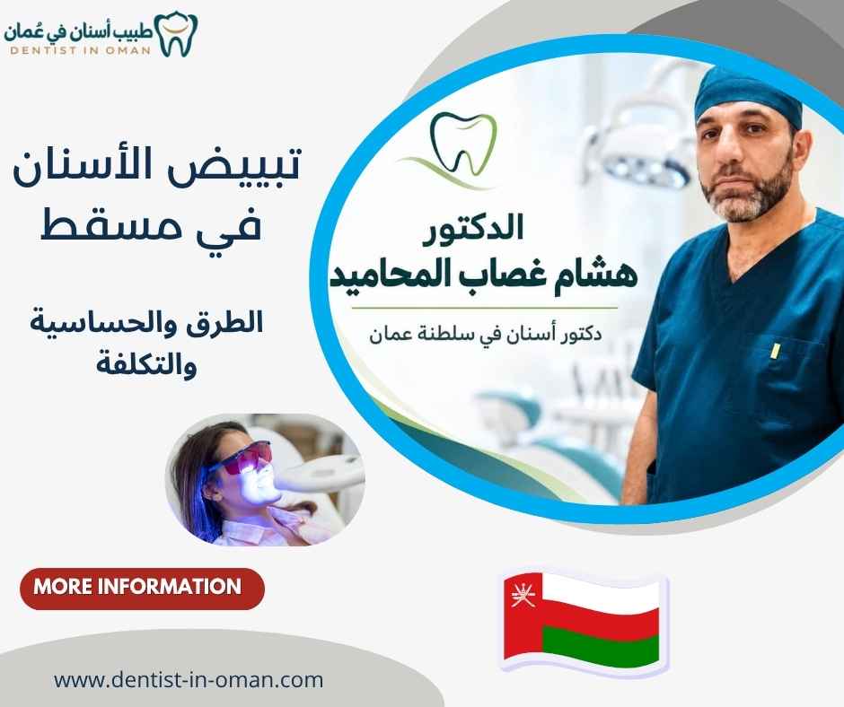 تبييض الأسنان في مسقط