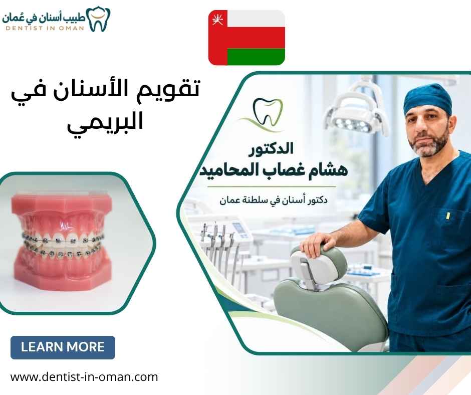 تقويم الأسنان في البريمي