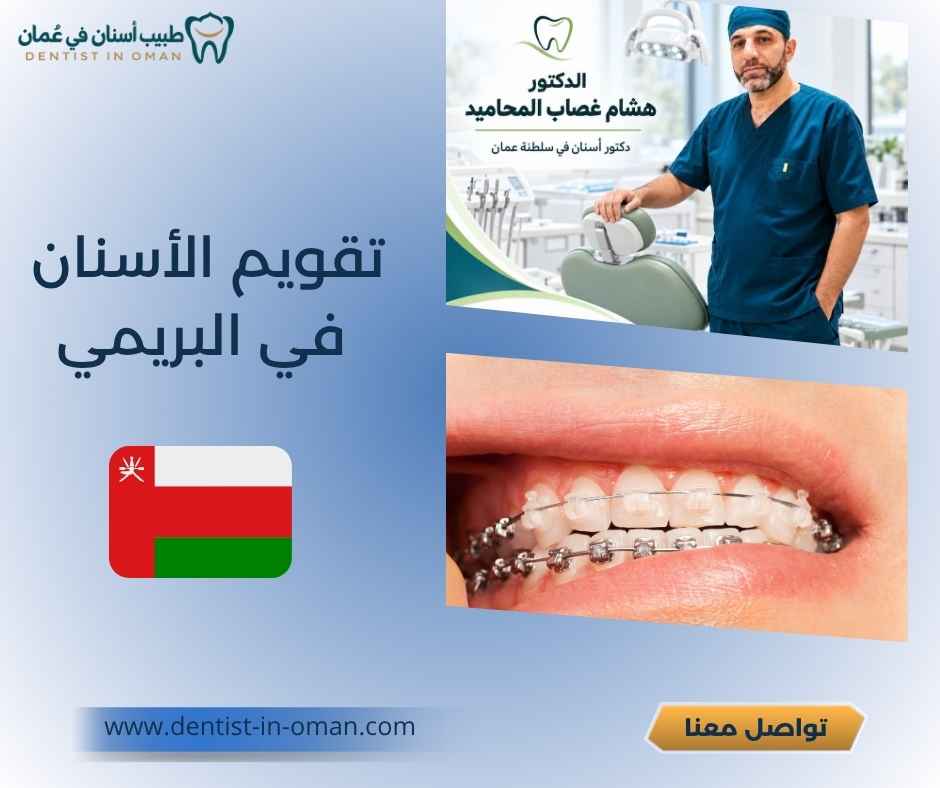 تقويم الأسنان في البريمي