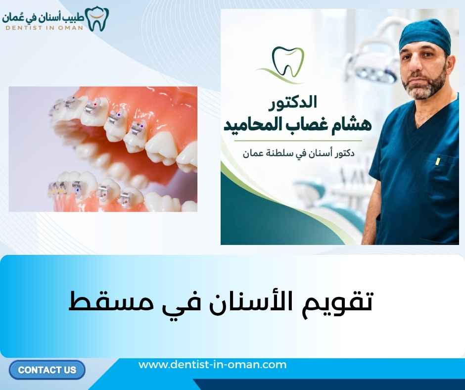 تقويم الأسنان في مسقط