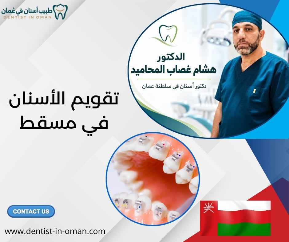 تقويم الأسنان في مسقط