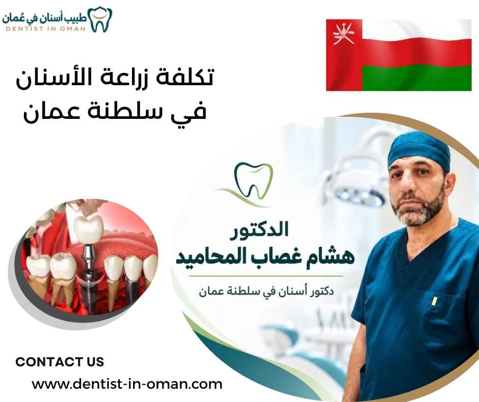 تكلفة زراعة الأسنان في سلطنة عمان