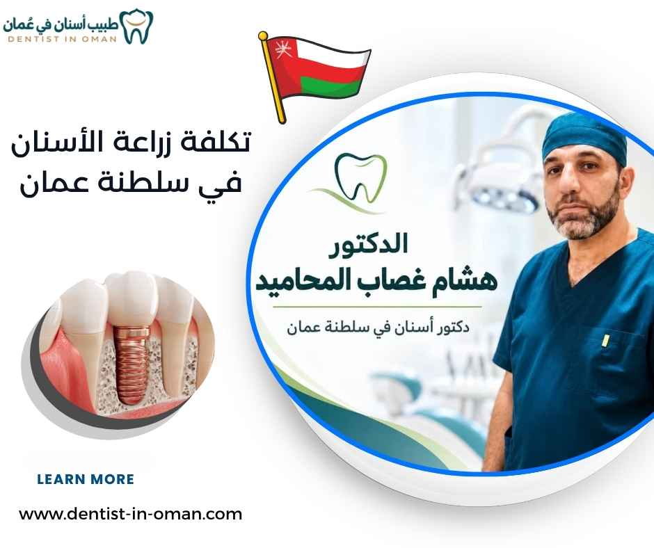 تكلفة زراعة الأسنان في سلطنة عمان
