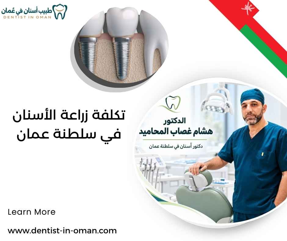 تكلفة زراعة الأسنان في سلطنة عمان
