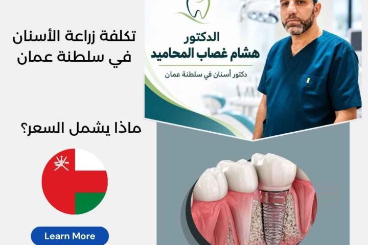 تكلفة زراعة الأسنان في سلطنة عمان