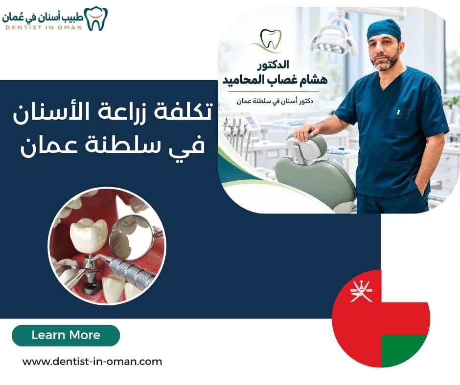 تكلفة زراعة الأسنان في سلطنة عمان