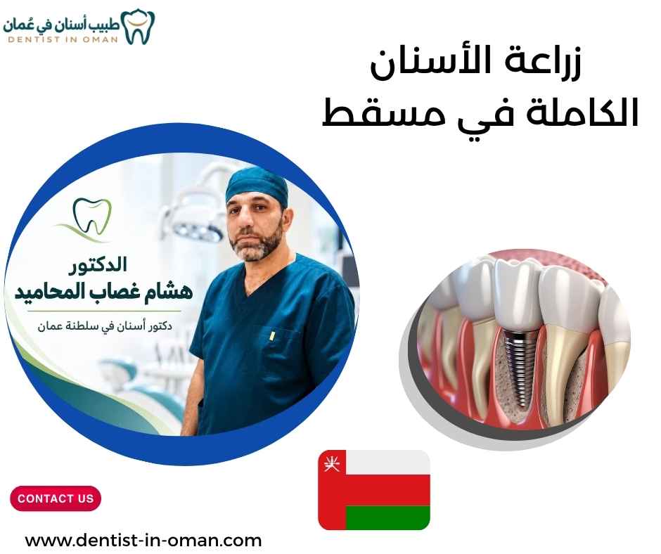 زراعة الأسنان الكاملة في مسقط 