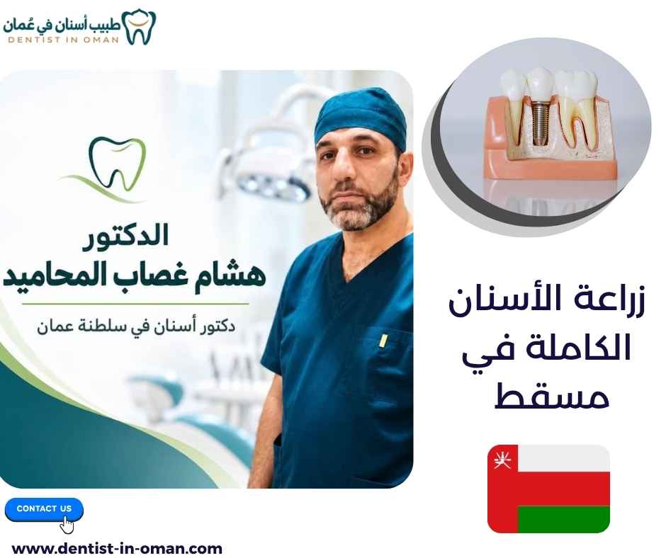 زراعة الأسنان الكاملة في مسقط 