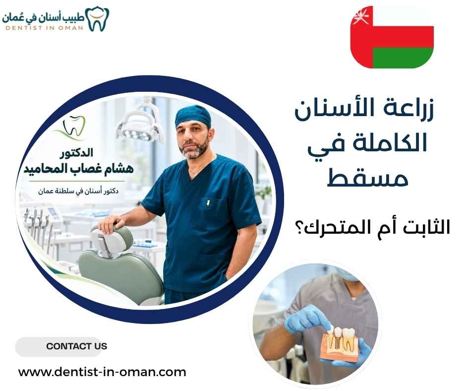 زراعة الأسنان الكاملة في مسقط