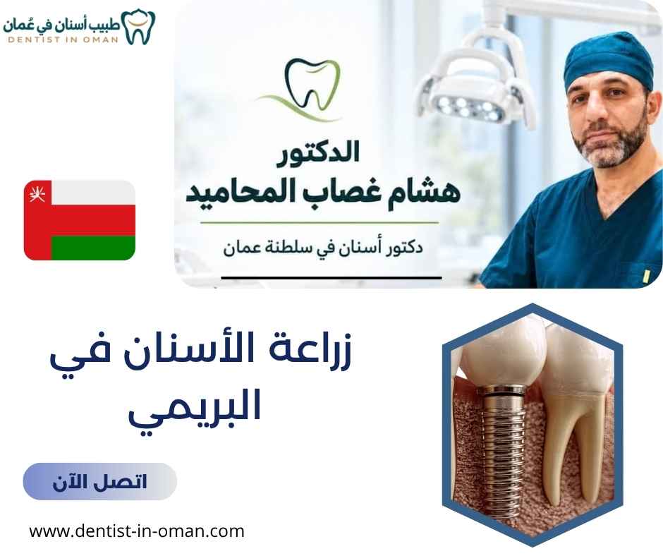 زراعة الأسنان في البريمي