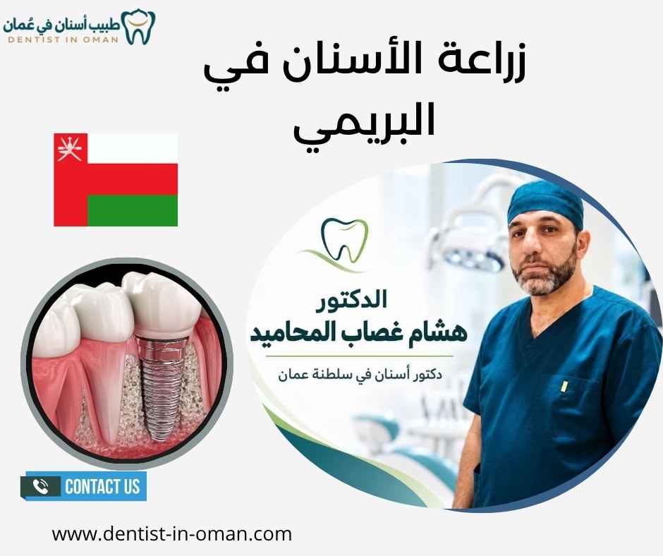 زراعة الأسنان في البريمي