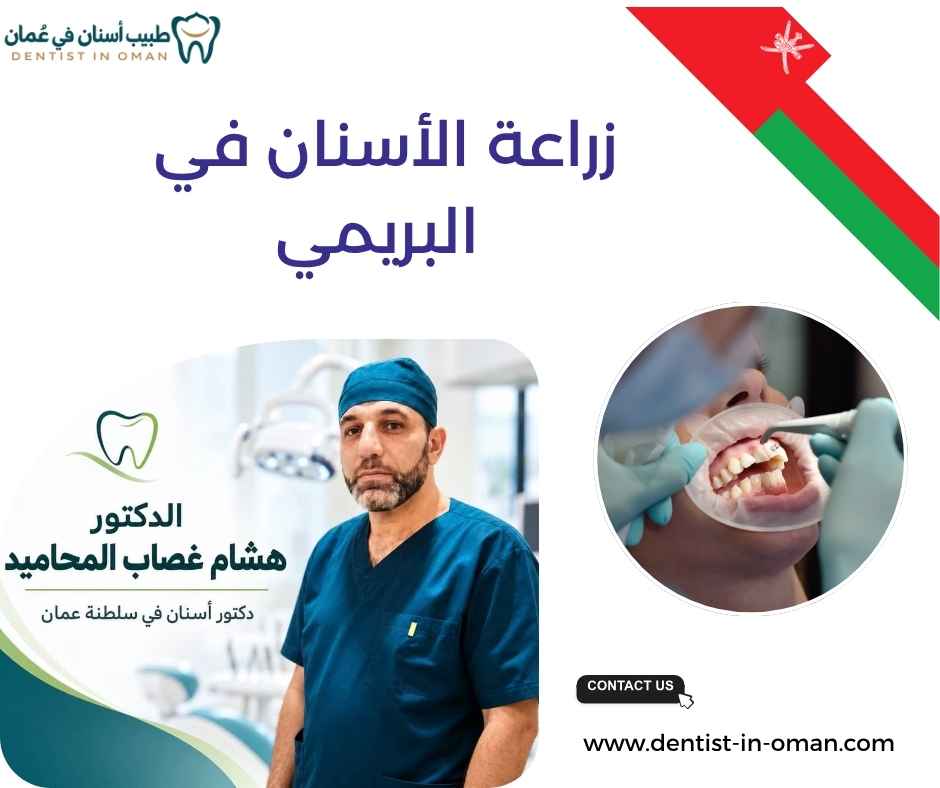 زراعة الأسنان في البريمي