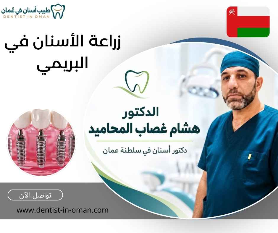 زراعة الأسنان في البريمي