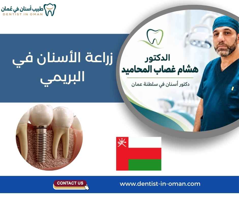 زراعة الأسنان في البريمي