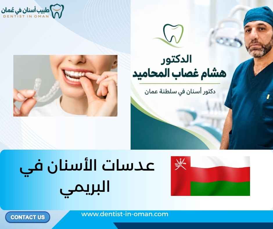 عدسات الأسنان في البريمي