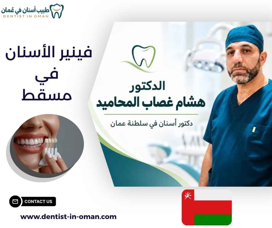 فينير الأسنان في مسقط