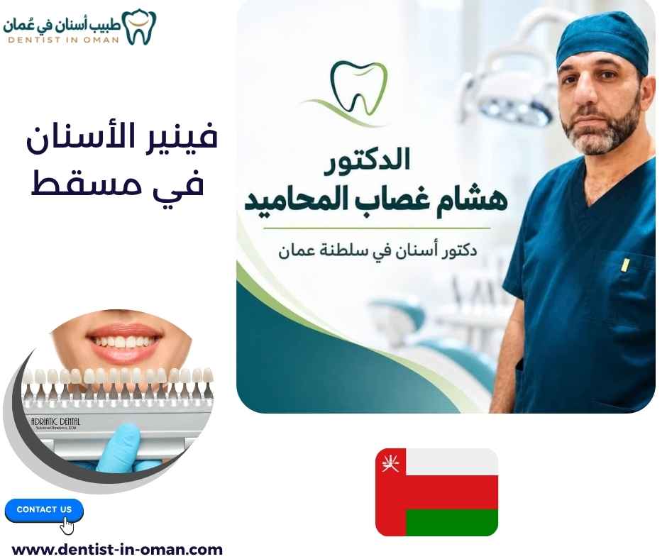 فينير الأسنان في مسقط