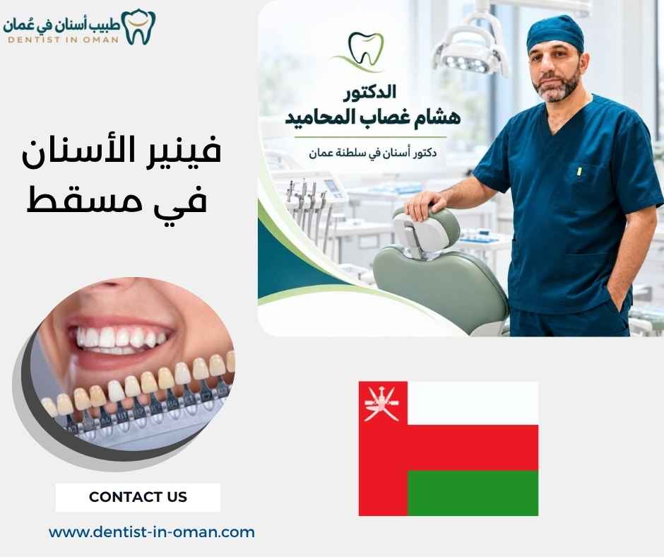 فينير الأسنان في مسقط