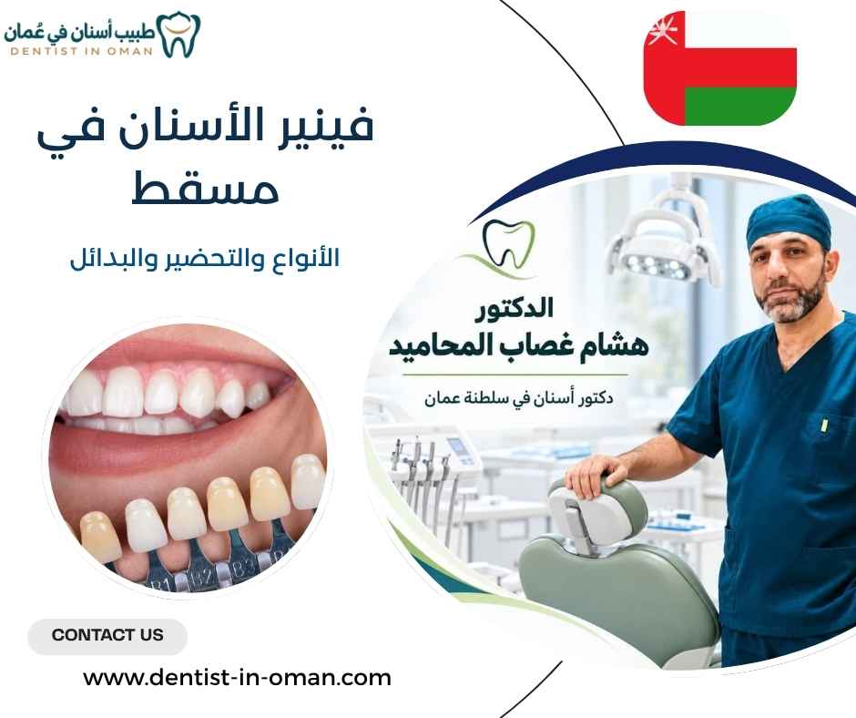 فينير الأسنان في مسقط