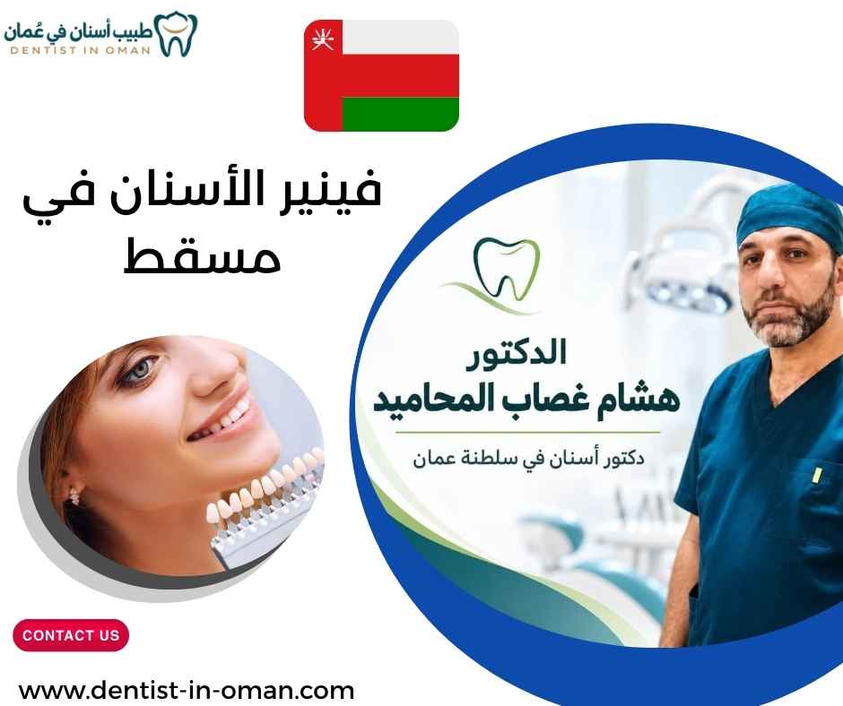 فينير الأسنان في مسقط
