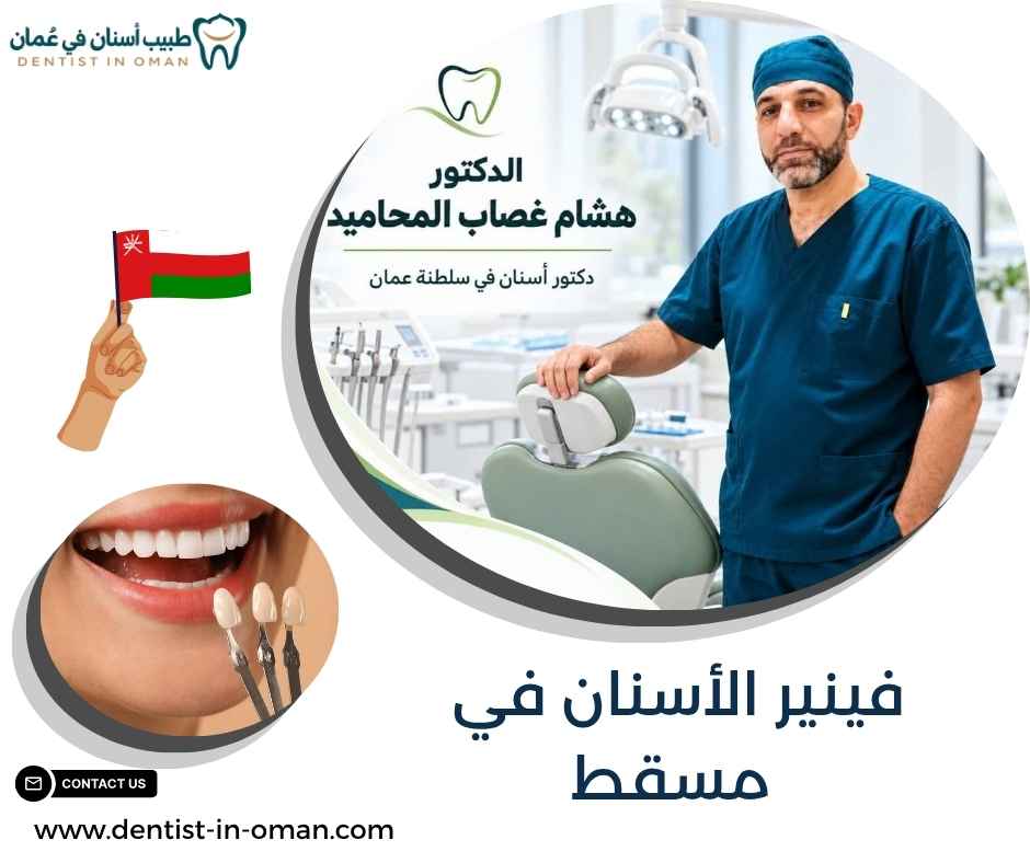 فينير الأسنان في مسقط